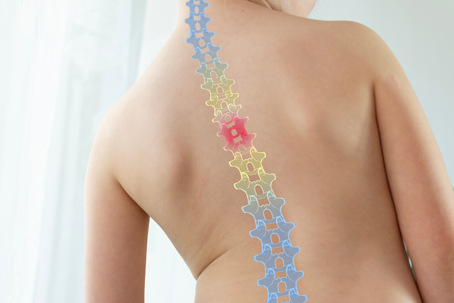 Physiotherapie bei Kindern mit Skoliosen -Wirbelsäule aufrichten
