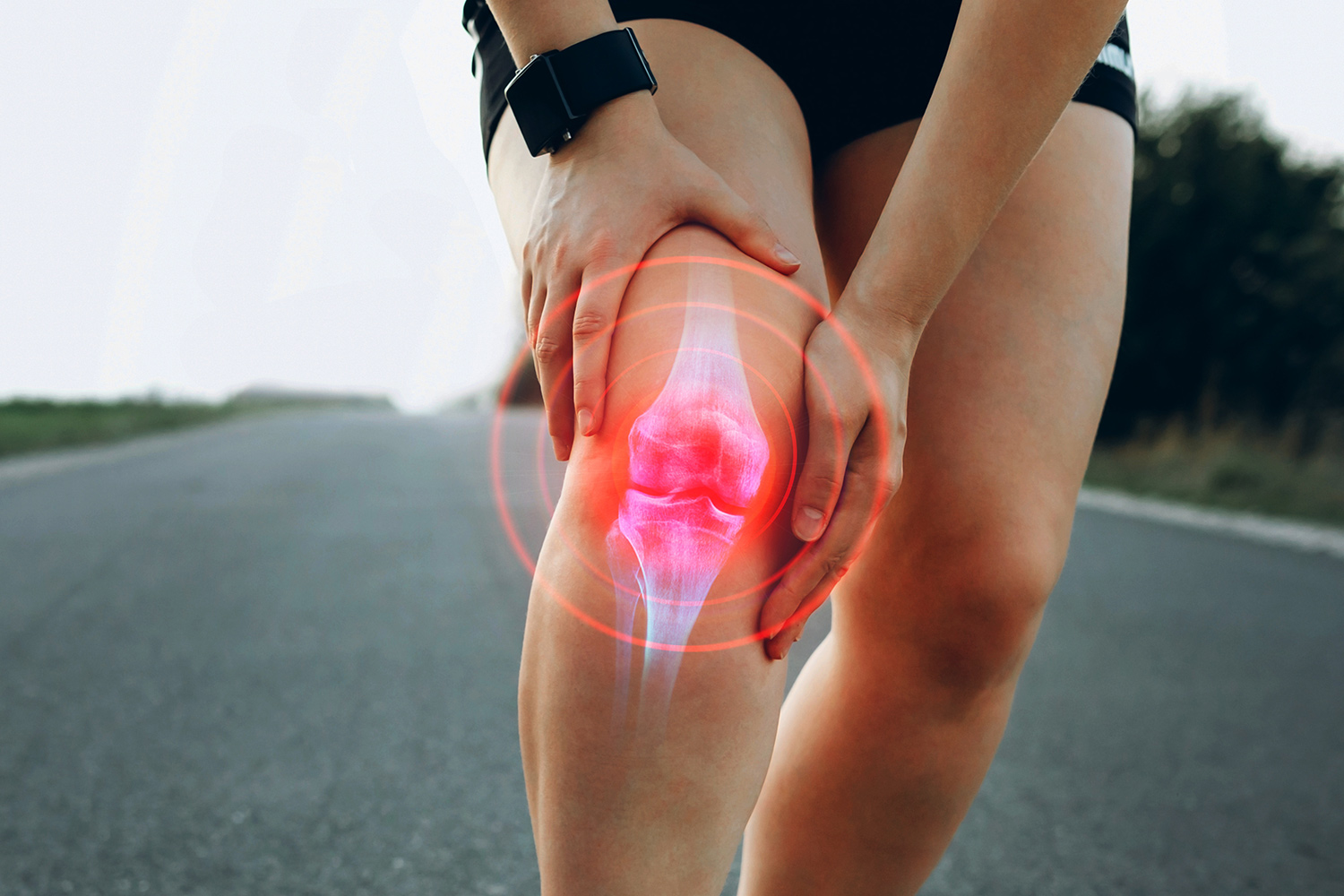 Physiotherapie bei Knieschmerzen